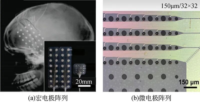 植入式皮层宏电极和微电极阵列对比图