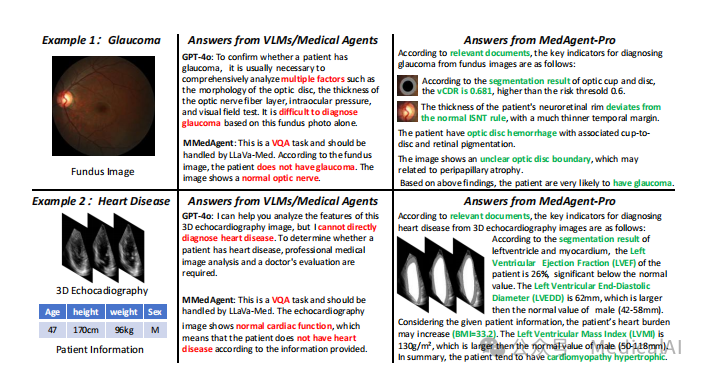 MedAgent-Pro对比案例：青光眼与心脏病诊断