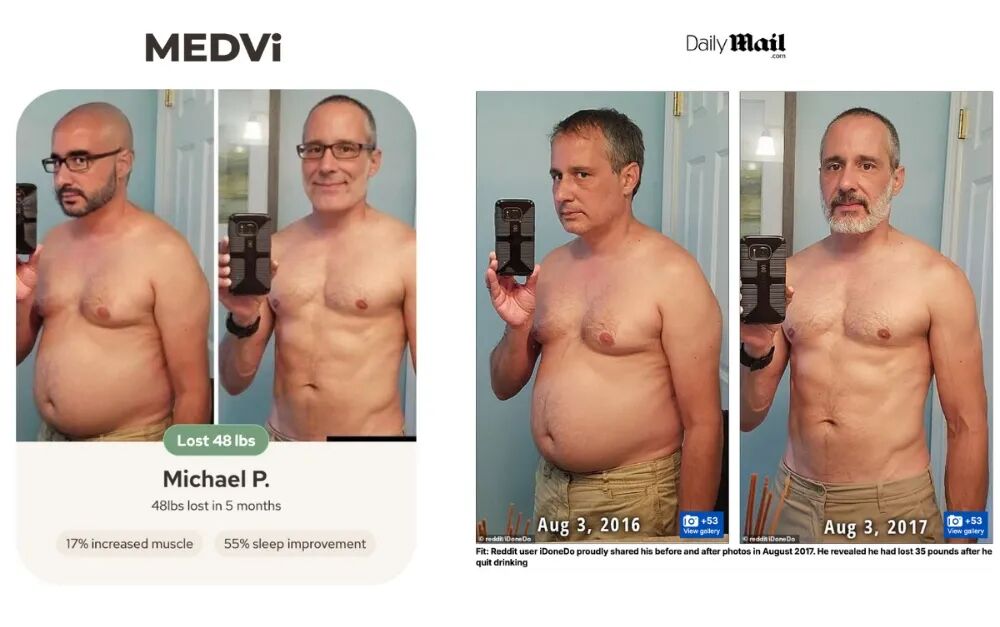 MEDVi盗图AI换脸与真实来源对比