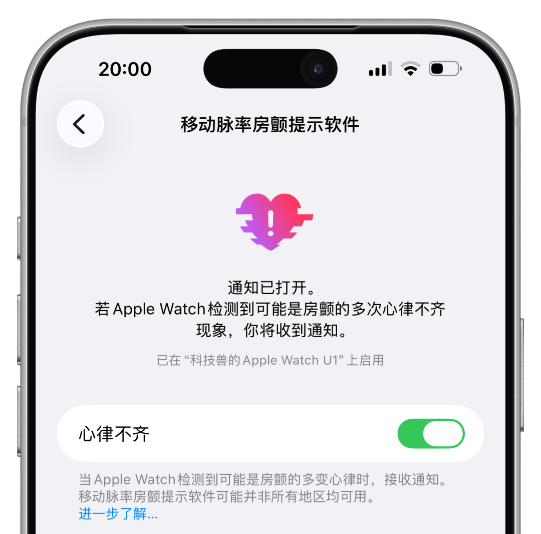 Apple Watch心律不齐通知设置界面