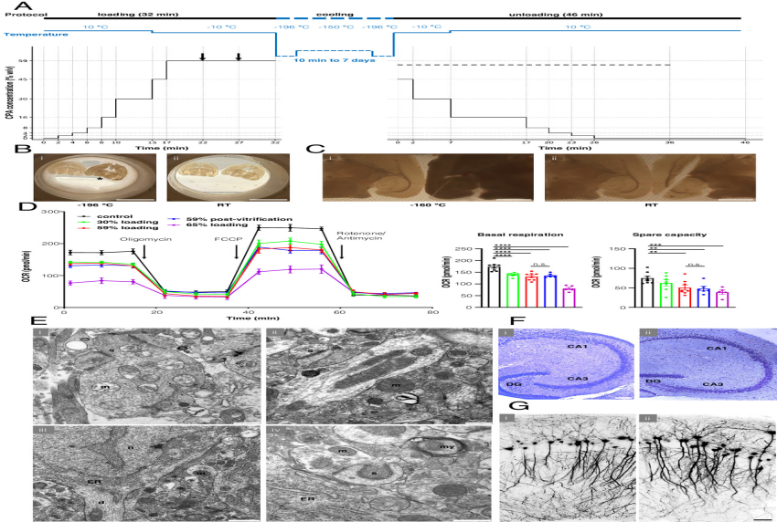 冷冻与新鲜脑组织功能与形态对比图