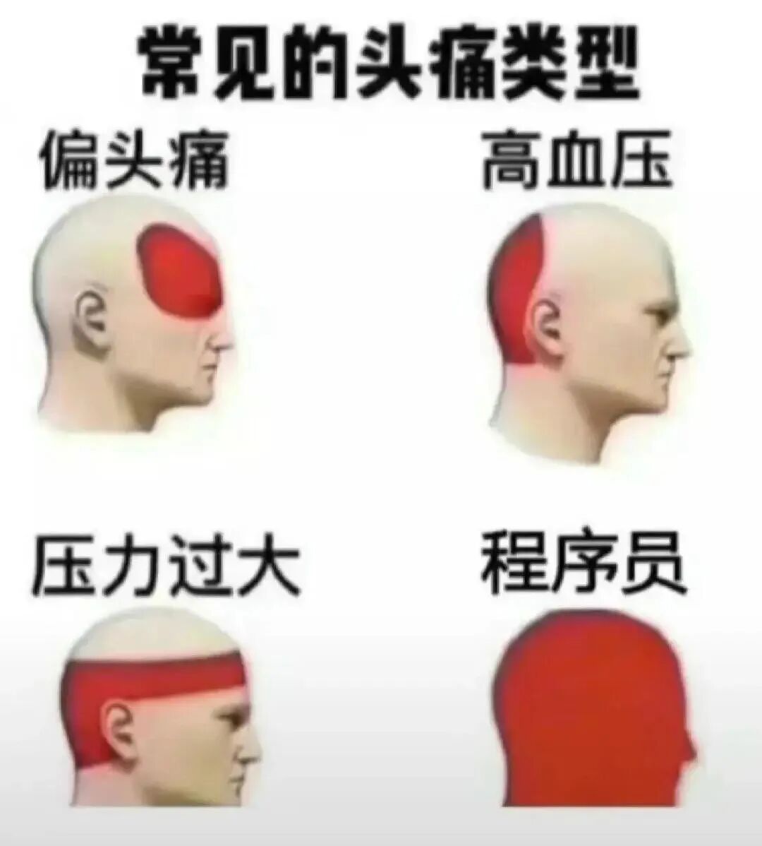 程序员专属头痛类型
