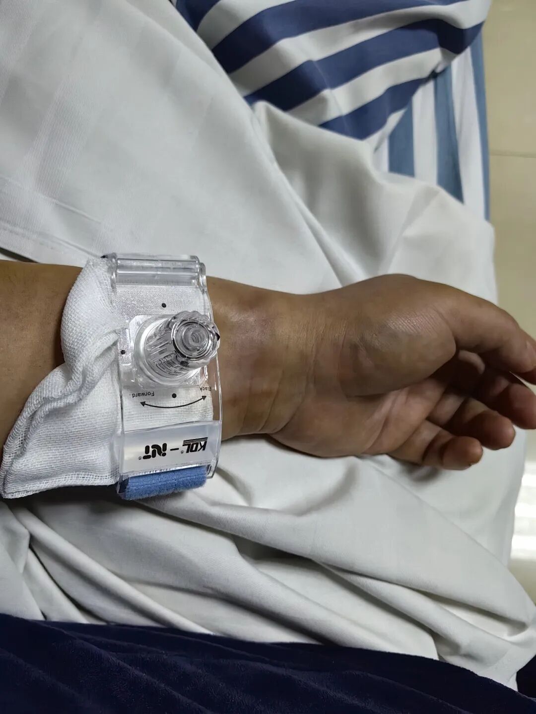 术后手腕上佩戴的医疗设备