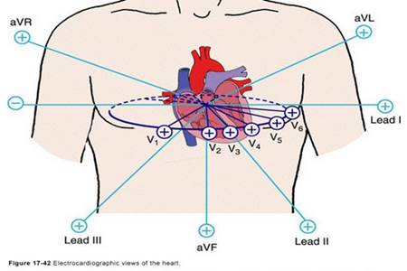 标准12导联心电图的电极位置与Heart视图