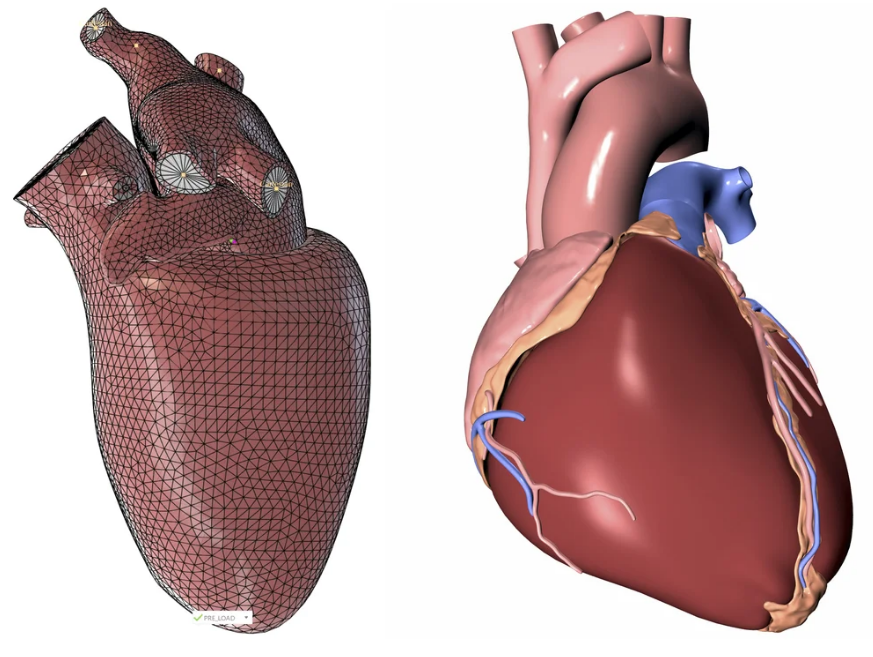 三维心脏有限元网格模型与解剖模型对比图