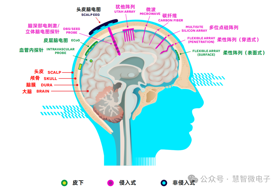 连接大脑的主要技术路径