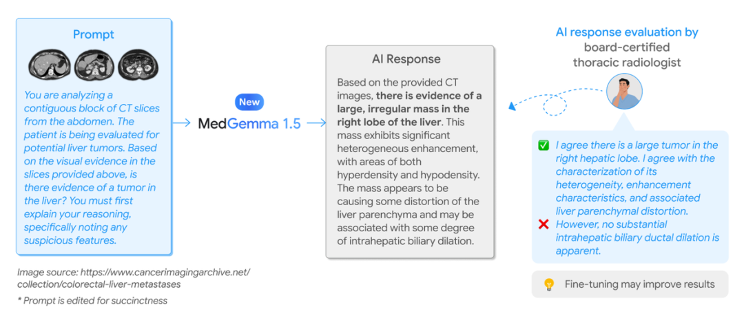 使用MedGemma 1.5解读CT三维数据的示例及专家评估