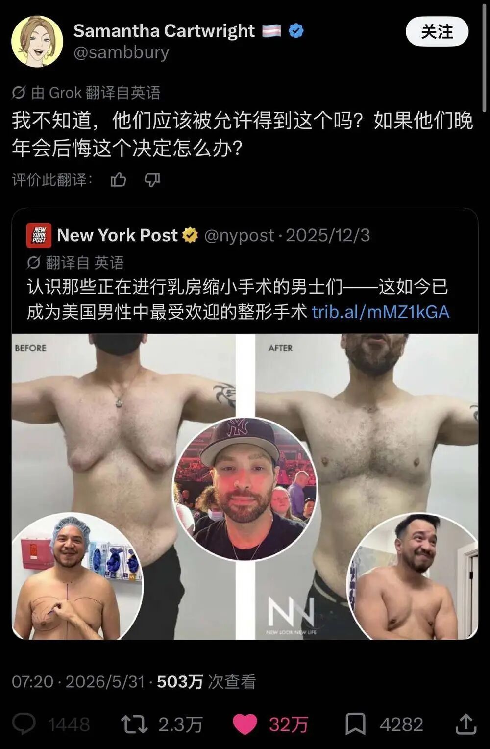 推文截图:我不知道,他们应该被允许得到这个吗?(男士乳房缩小手术)