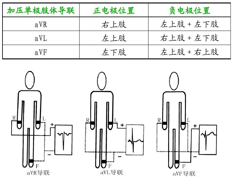 加压肢体导联电极位置与计算公式