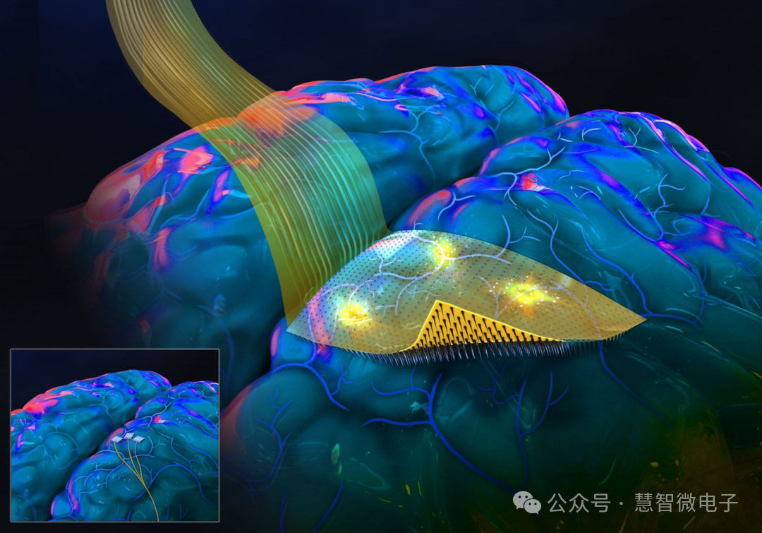 脑机接口技术所用到的柔性电极