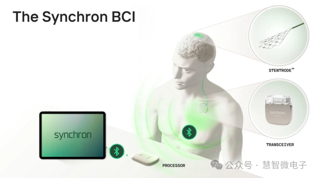 Synchron介入式脑机接口产品
