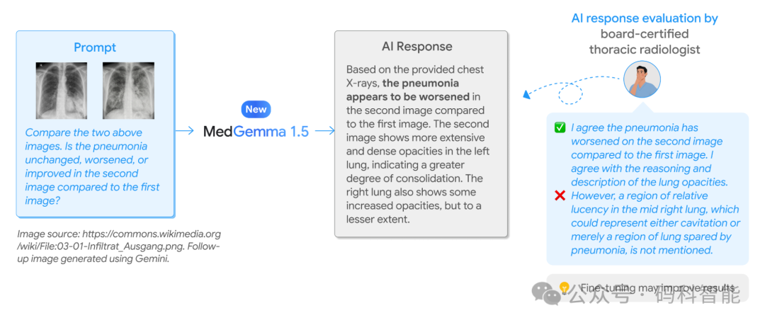 MedGemma 1.5 诊断分析示例