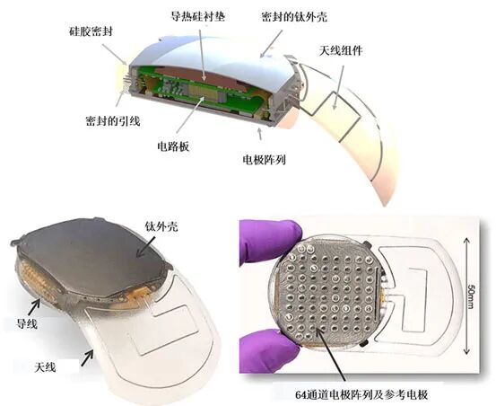 法国Clinatec公司的Wimagine硬膜外无线记录系统结构图