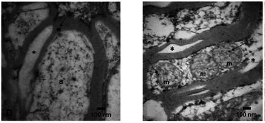 电子显微镜下显示磁性颗粒对神经细胞结构造成损伤的图像