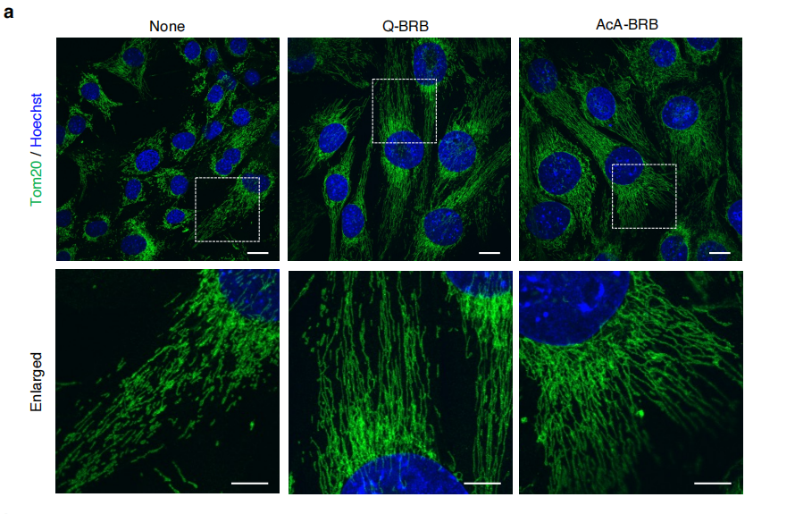 对照组与处理组线粒体形态对比