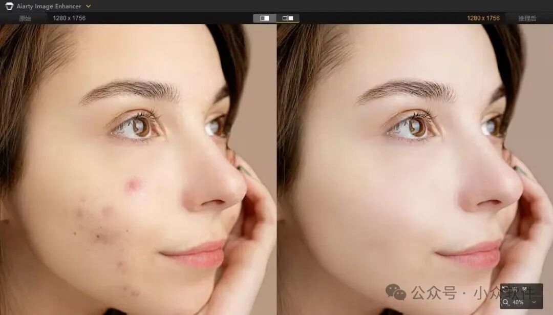 Aiarty AI消除功能演示：消除女性侧脸的痘印和皮肤瑕疵