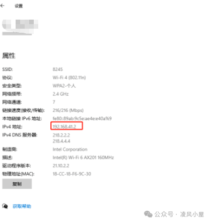 本地网络连接详情