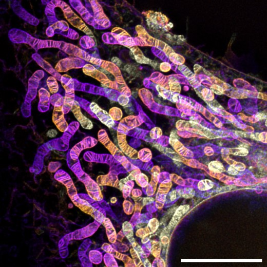 STED超分辨荧光显微镜下的线粒体网络结构